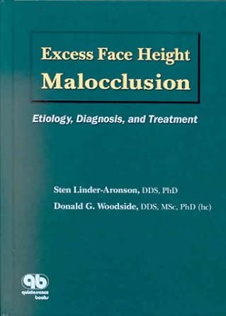 Excess Face Height Malocclusion: Etiology, Diagnosis, and Treatment cover image